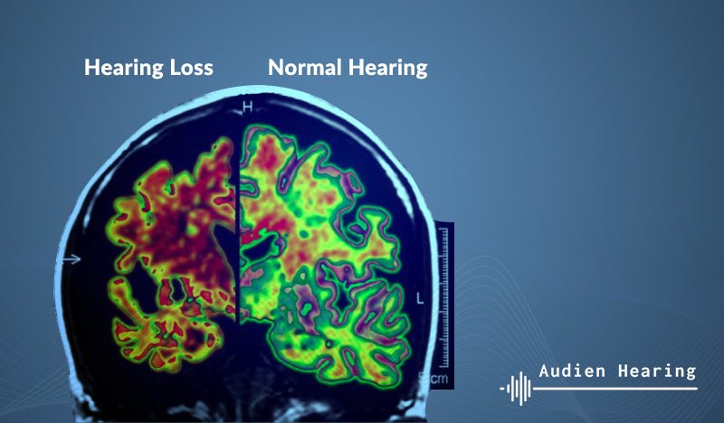 New Research Connects Hearing  Loss To Alzheimer's, Dementia, Depression & More...